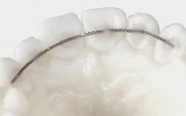 Preview: Bond & Go smartFLEX-8 Retainer-Draht, .016